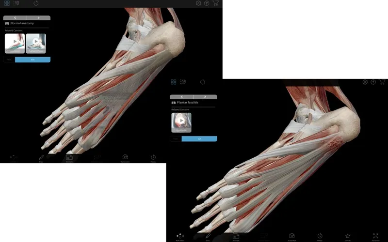 visible-body-muscle-premium2 visible body muscle premium2